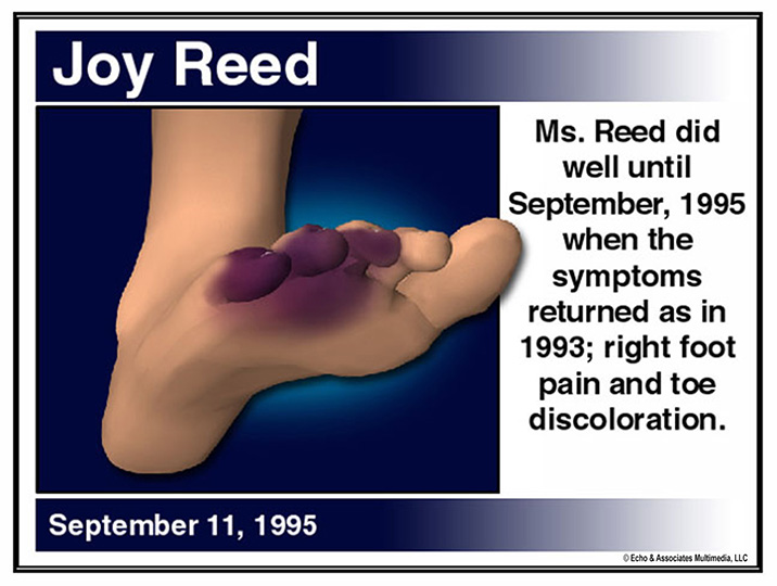 Foot Injury Medical Diagram